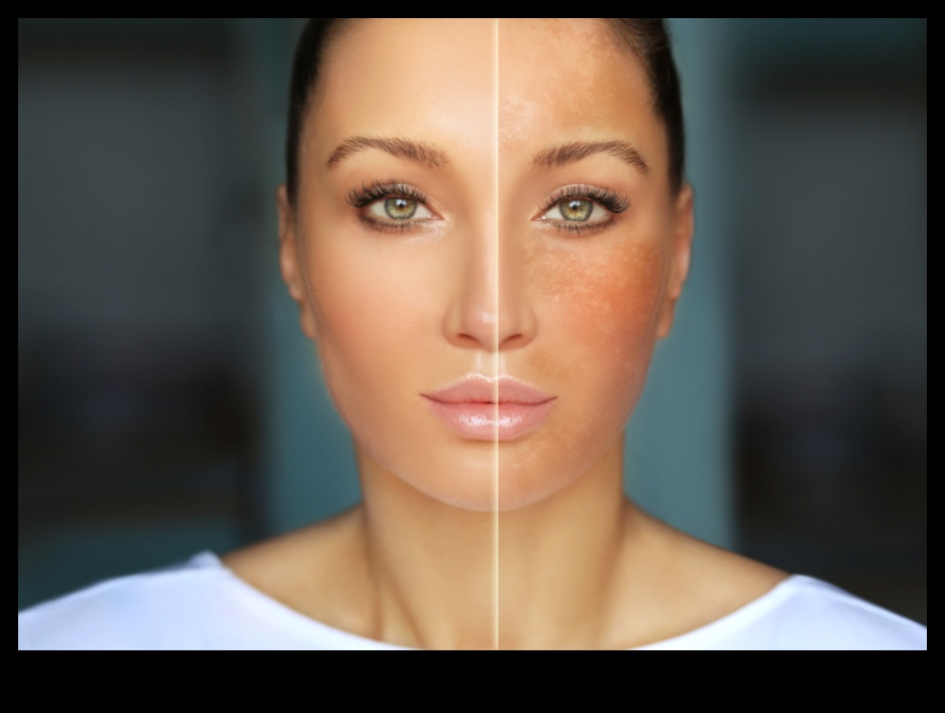 Ο αντίκτυπος της ρύπανσης στο δέρμα σας: θωράκιση κατά των περιβαλλοντικών στρεσογόνων παραγόντων